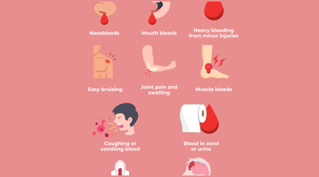 Signs and Symptoms of Spontaneous Bleeding Include